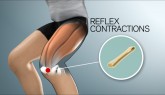 Compex